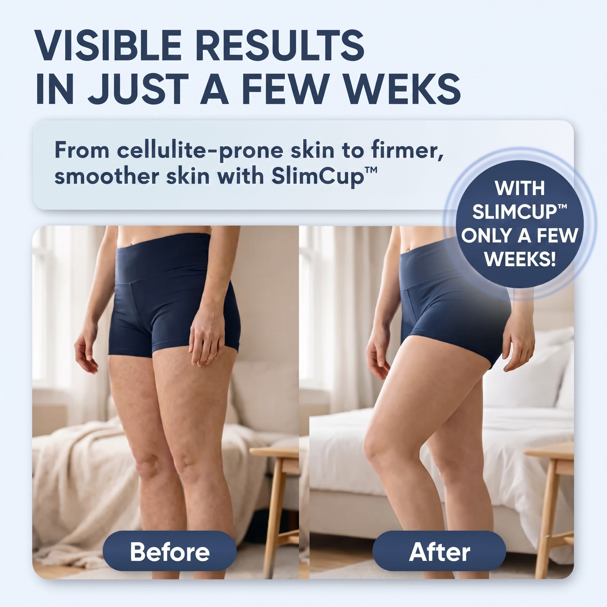 SlimCup™ Vacuum Massager